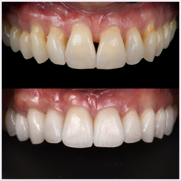21-b-full-mouth-rehab